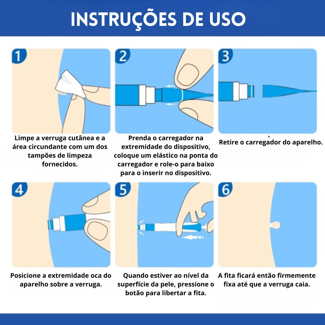 Kit anti-verrugas | Zero Verrugas