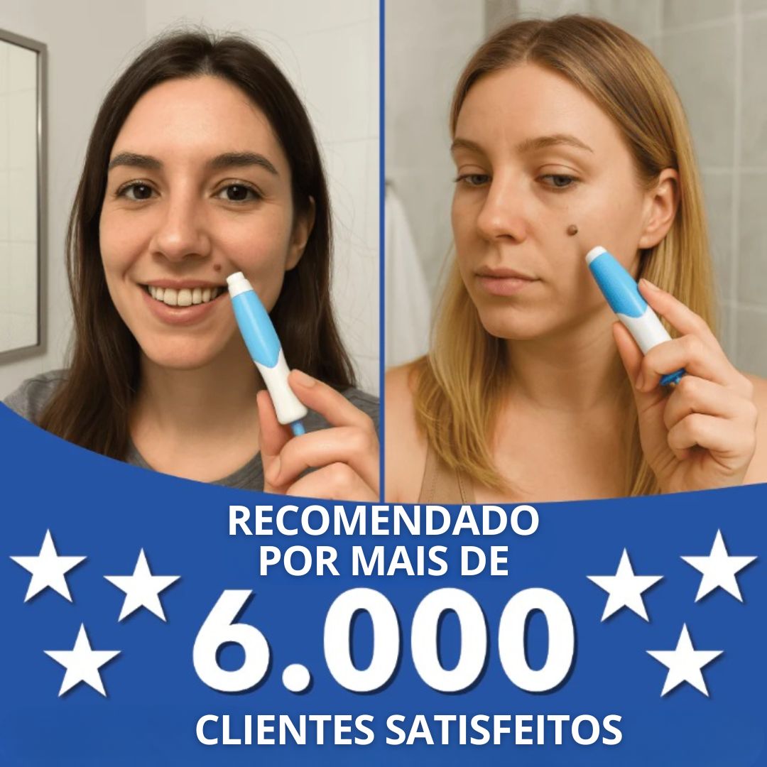 Kit anti-verrugas | Zero Verrugas